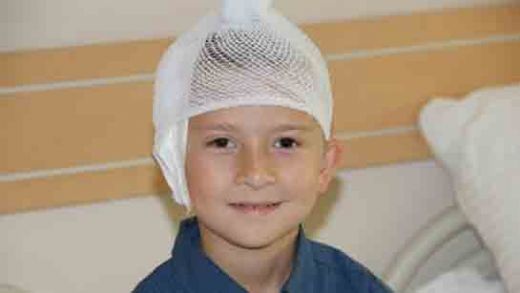 Çocuklarda Beyin Kanaması Belirtileri ve Tedavisi