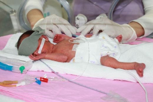 Prematüre Bebeklerde Beyin Kanaması Tedavisi